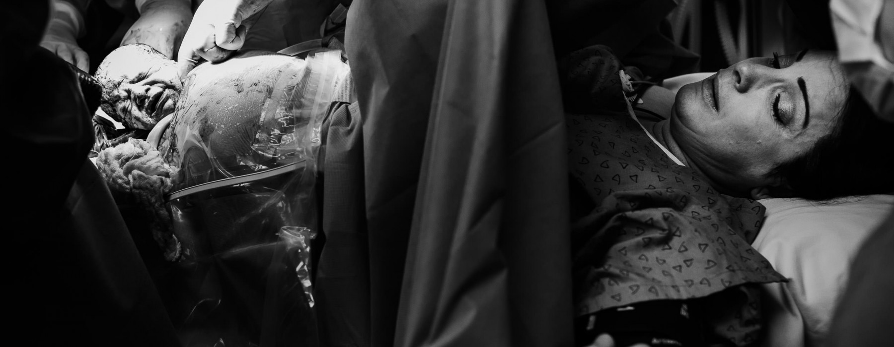 fotografia de parto nascimento