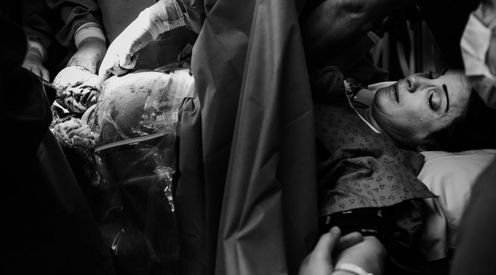 fotografia de parto nascimento